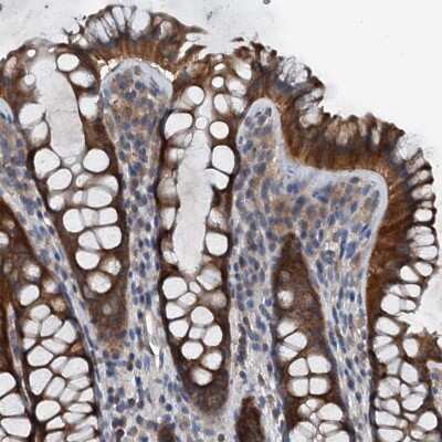 Immunohistochemistry-Paraffin: DPS Antibody [NBP1-85511]