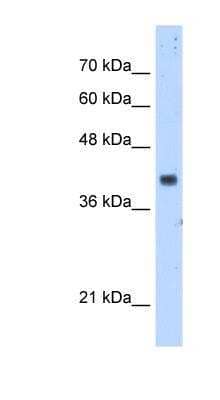 Western Blot: DPS Antibody [NBP1-54645]