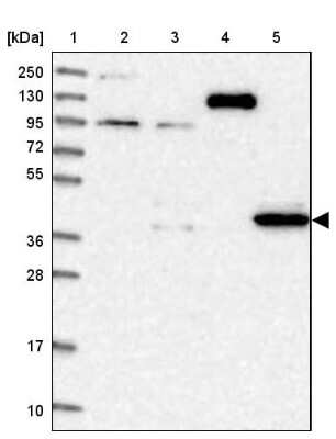 Western Blot: DPS Antibody [NBP1-85511]