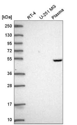 Western Blot: DPS Antibody [NBP2-55185]