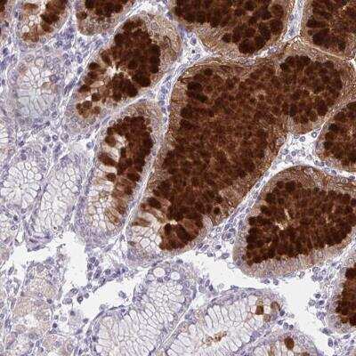 Immunohistochemistry-Paraffin: DPY19L1 Antibody [NBP2-31748]