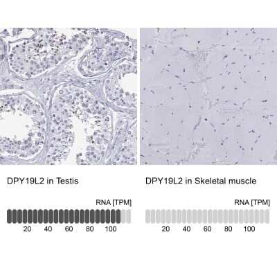 Immunocytochemistry/ Immunofluorescence: DPY19L2 Antibody [NBP3-17123]