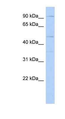 Western Blot: DPY19L2 Antibody [NBP1-62195]