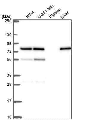 Western Blot: DPY19L2 Antibody [NBP2-56009]