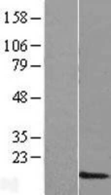 Western Blot: DPY19L3 Overexpression Lysate [NBL1-13072]