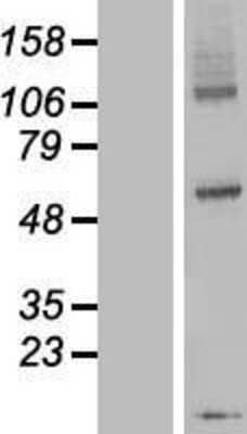 Western Blot: DPY19L3 Overexpression Lysate [NBP2-04511]