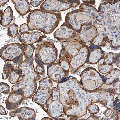 Immunohistochemistry-Paraffin: DPY19L4 Antibody [NBP1-91057]