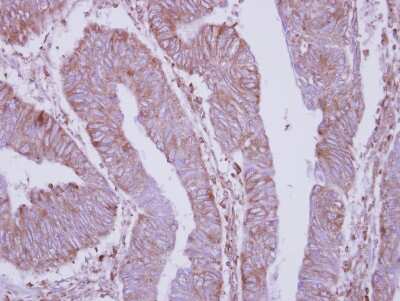 Immunohistochemistry-Paraffin: DPY19L4 Antibody [NBP2-16222]