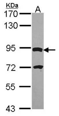 Western Blot: DPY19L4 Antibody [NBP2-16222]