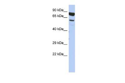 Western Blot: DPY19L4 Antibody [NBP2-84820]