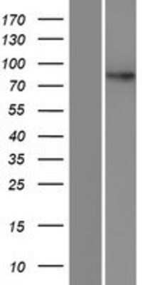 Western Blot: DPY19L4 Overexpression Lysate [NBP2-04890]