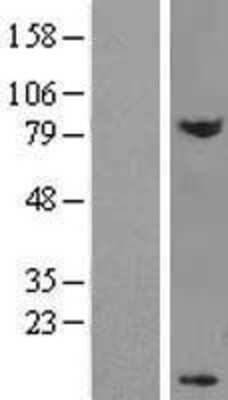 Western Blot: DPY30 Overexpression Lysate [NBL1-10007]