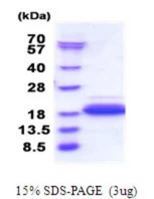 SDS-PAGE: Recombinant Human DPY30 His Protein [NBP2-51810]