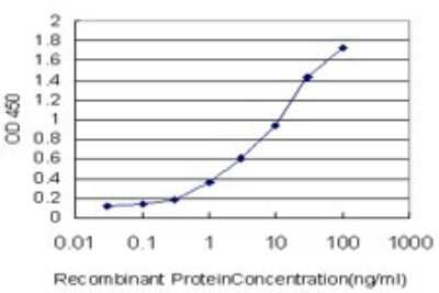 ELISA: DPYD Antibody (7D4) [H00001806-M01]