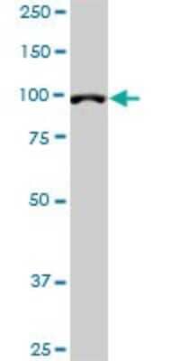 Western Blot: DPYD Antibody (7D4) [H00001806-M01]