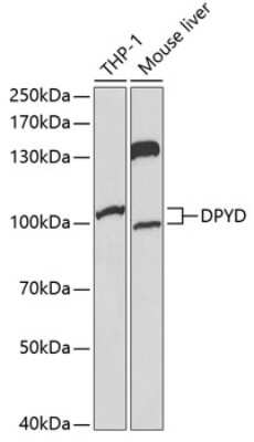 Western Blot: DPYD AntibodyBSA Free [NBP2-92308]