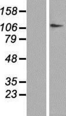 Western Blot: DPYD Overexpression Lysate [NBP2-09055]