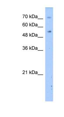 Western Blot: DPYS Antibody [NBP1-55121]