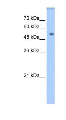 Western Blot: DPYS Antibody [NBP1-55122]