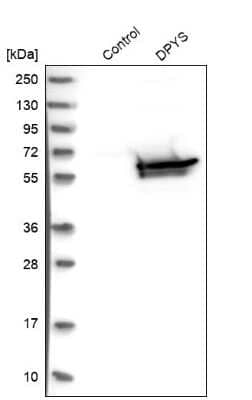 Western Blot: DPYS Antibody [NBP1-85224]