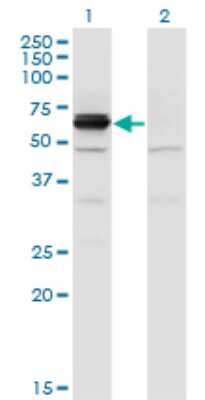 Western Blot: DPYSL4 Antibody (1F5) [H00010570-M01]