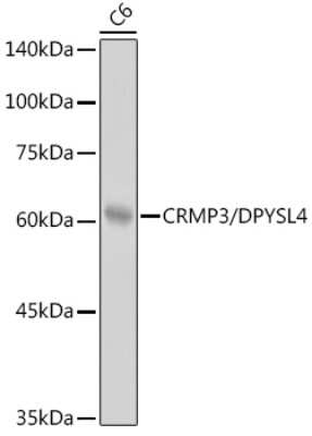 Western Blot: DPYSL4 Antibody (8N2S10) [NBP3-15288]