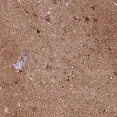 Immunohistochemistry-Paraffin: DPYSL4 Antibody [NBP2-13937]