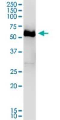 Western Blot: DPYSL4 Antibody [H00010570-B01P]