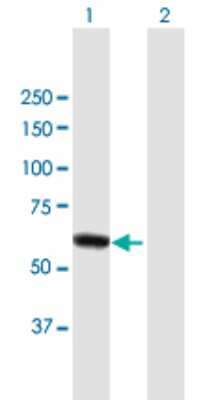 Western Blot: DPYSL4 Antibody [H00010570-B01P]