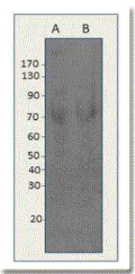 Western Blot: DPYSL4 Antibody [NBP2-11055]