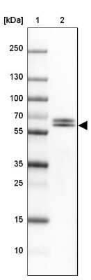 Western Blot: DPYSL4 Antibody [NBP2-13937]