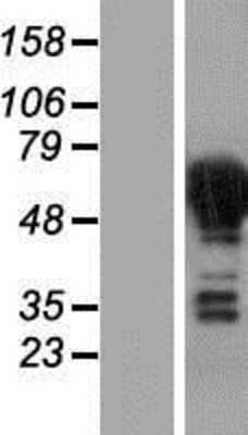 Western Blot: DPYSL4 Overexpression Lysate [NBP2-07621]