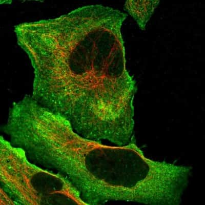 Immunocytochemistry/ Immunofluorescence: DQX1 Antibody [NBP1-91849]