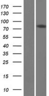 Western Blot: DQX1 Overexpression Lysate [NBP2-05693]