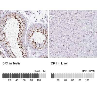 Immunohistochemistry-Paraffin: DR1 Antibody [NBP2-47480]