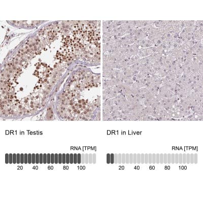 Immunohistochemistry-Paraffin: DR1 Antibody [NBP2-48979]