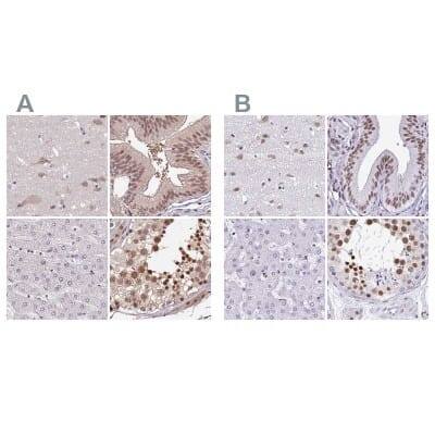 Immunohistochemistry-Paraffin: DR1 Antibody [NBP2-48979]