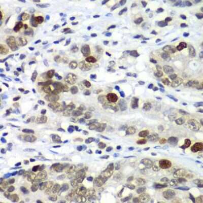 Immunohistochemistry-Paraffin: DR1 Antibody - BSA Free [NBP2-92857]
