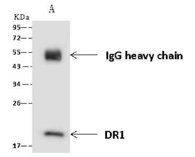 Immunoprecipitation: DR1 Antibody [NBP2-97557]
