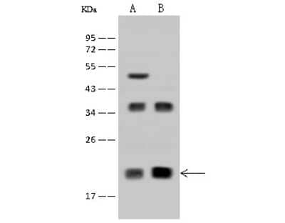 Western Blot: DR1 Antibody [NBP2-97557]