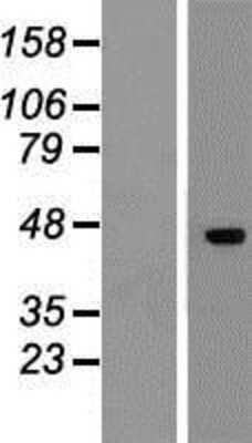 Western Blot: DR3/TNFRSF25 Overexpression Lysate [NBP2-10549]