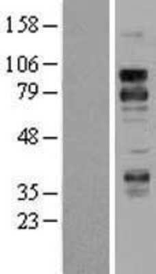 Western Blot: DR6/TNFRSF21 Overexpression Lysate [NBL1-17156]