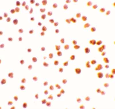 Immunocytochemistry/ Immunofluorescence: DRAK1 Antibody - BSA Free [NBP1-76896]