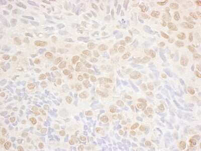 Immunohistochemistry-Paraffin: DRAK1 Antibody [NBP1-42693]