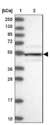 Western Blot: DRAK1 Antibody [NBP1-84981]