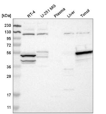 Western Blot: DRAK1 Antibody [NBP2-55328]