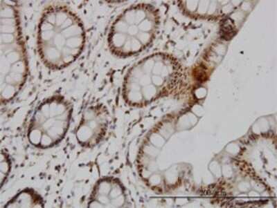 Immunohistochemistry-Paraffin: DRAK2 Antibody (2C3) [H00009262-M01]