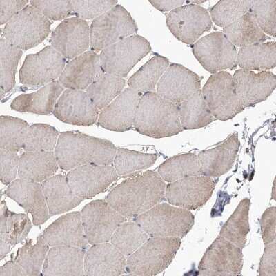 Immunohistochemistry-Paraffin: DRAK2 Antibody [NBP1-84980]
