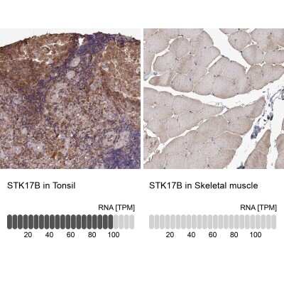 Immunohistochemistry-Paraffin: DRAK2 Antibody [NBP1-84980]