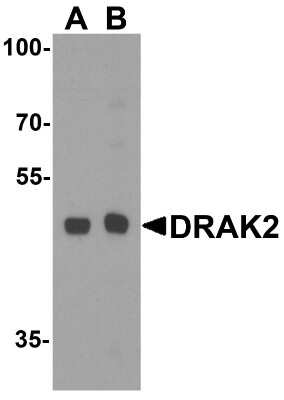 Western Blot: DRAK2 AntibodyBSA Free [NBP1-76885]